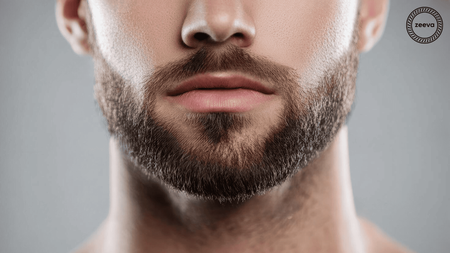 Beard transplant result