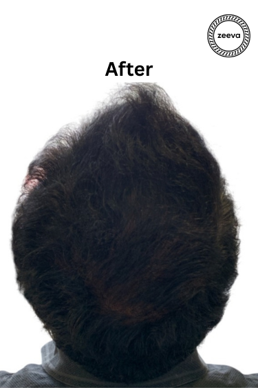 After