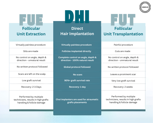 Hair Transplant in Ahmedabad