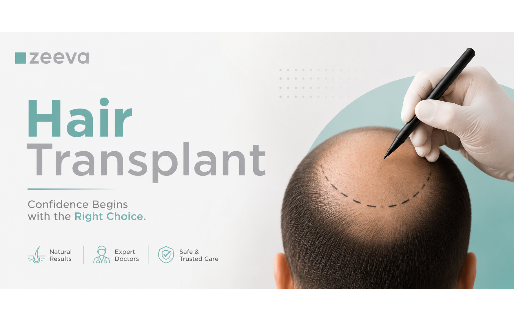 Hair transplant in Gujarat with expert doctors and trusted care