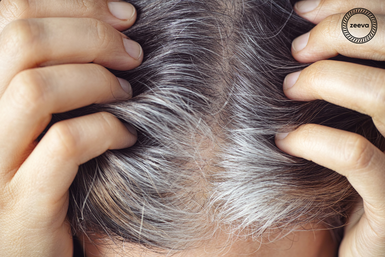 Gray hair causes and prevention