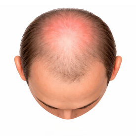Full Head