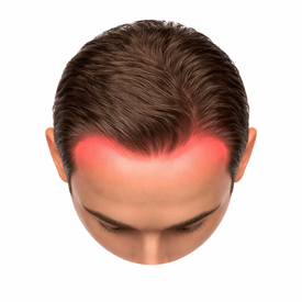Hairline