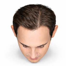 NW 2