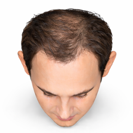NW 3