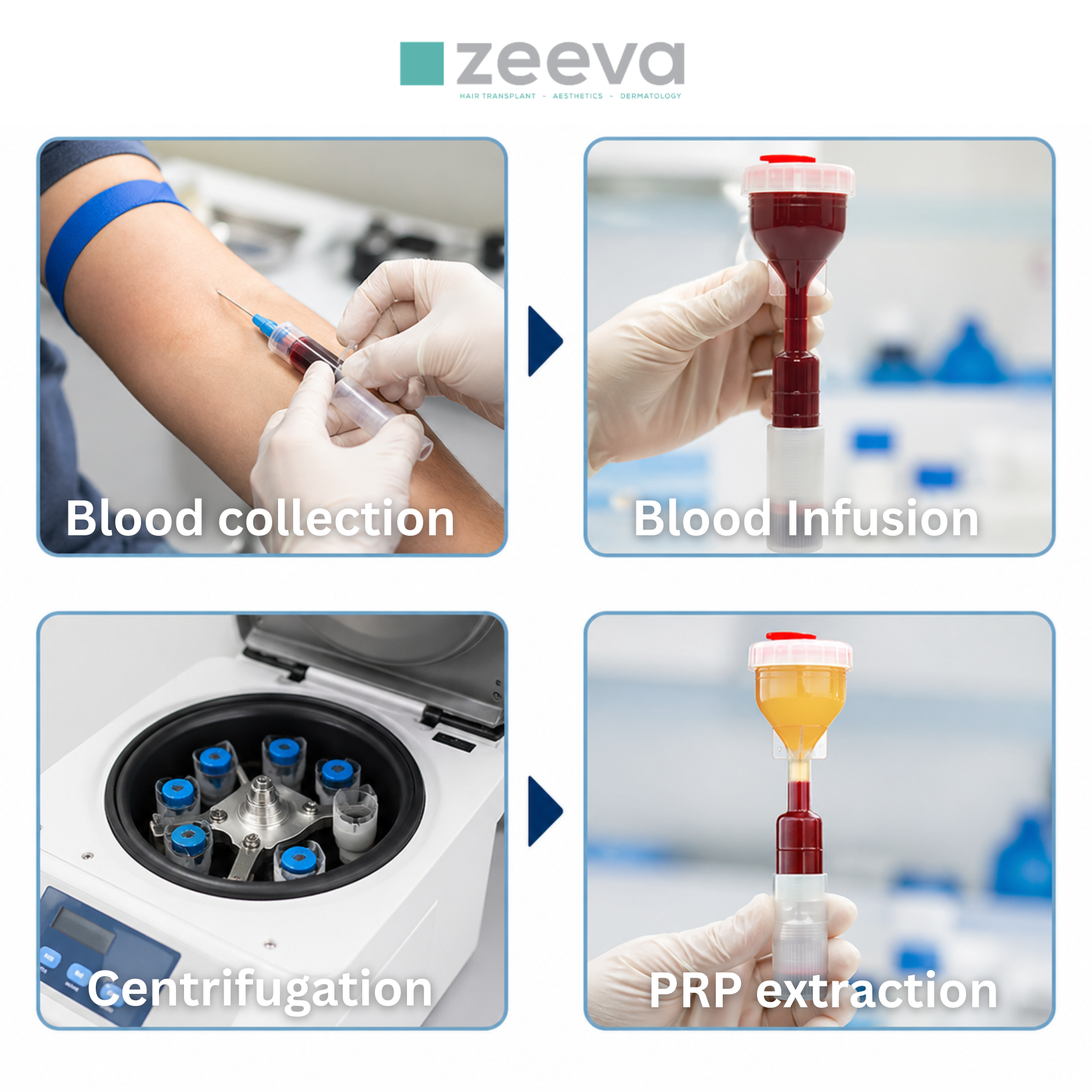 PRP Therapy process illustration