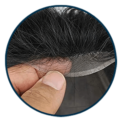 human-hair-patches